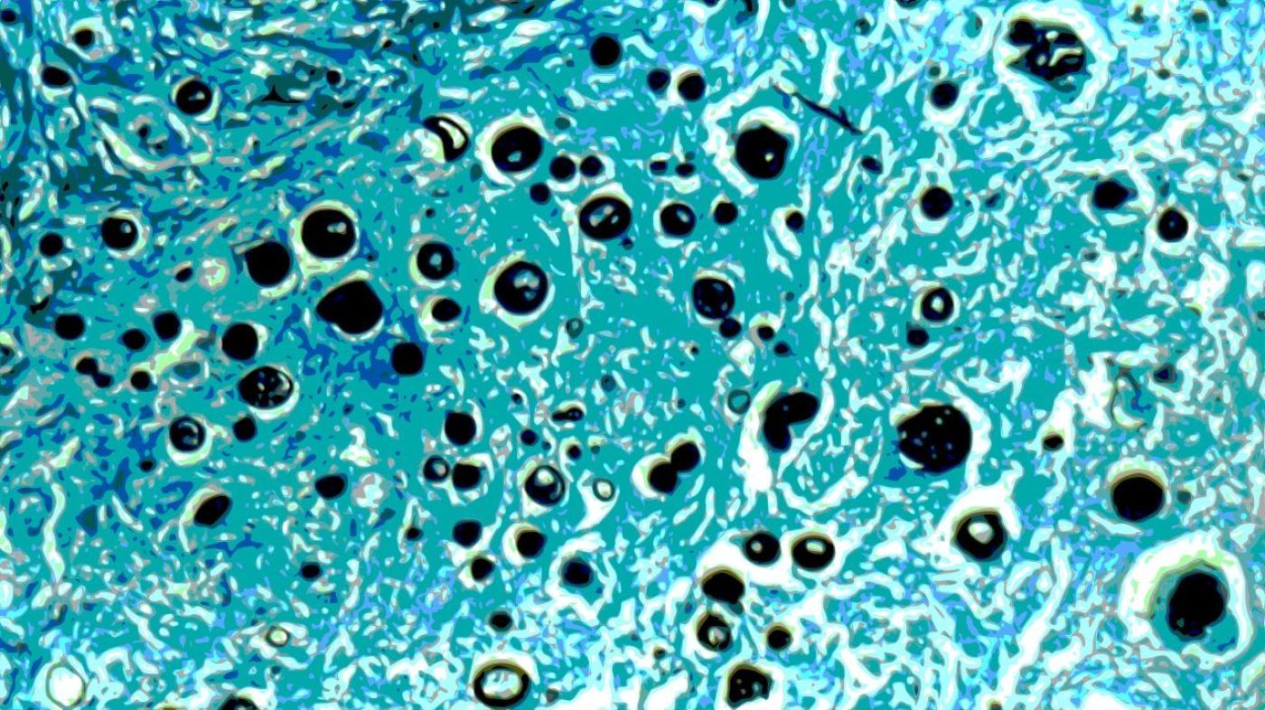 metabolism texture